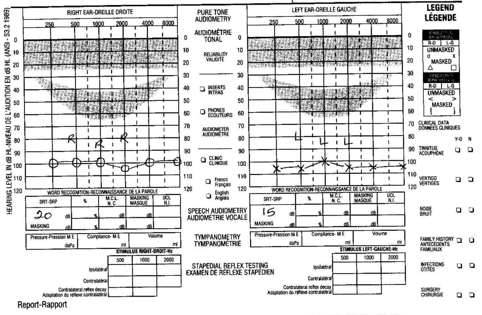 Blank Audiogram Template Download – Atlantaauctionco regarding Blank